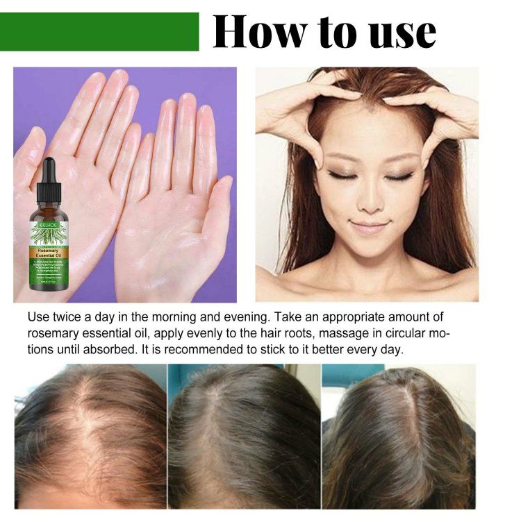 Rosemary Hair Care Essential Oil for Preventing Broken Hair and Hair Growth Essential Oil for Preventing Hair Loss and Nourishing Scalp Essential Oil